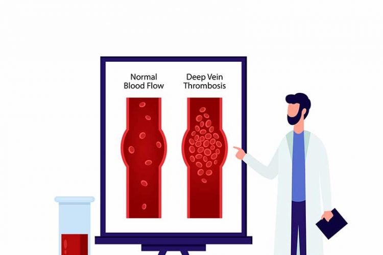 Best Angioplasty Surgeons in Vandalur, Tambaram , Chengalpattu