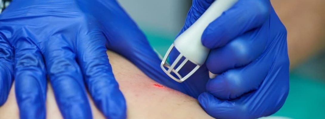 laser-surgery